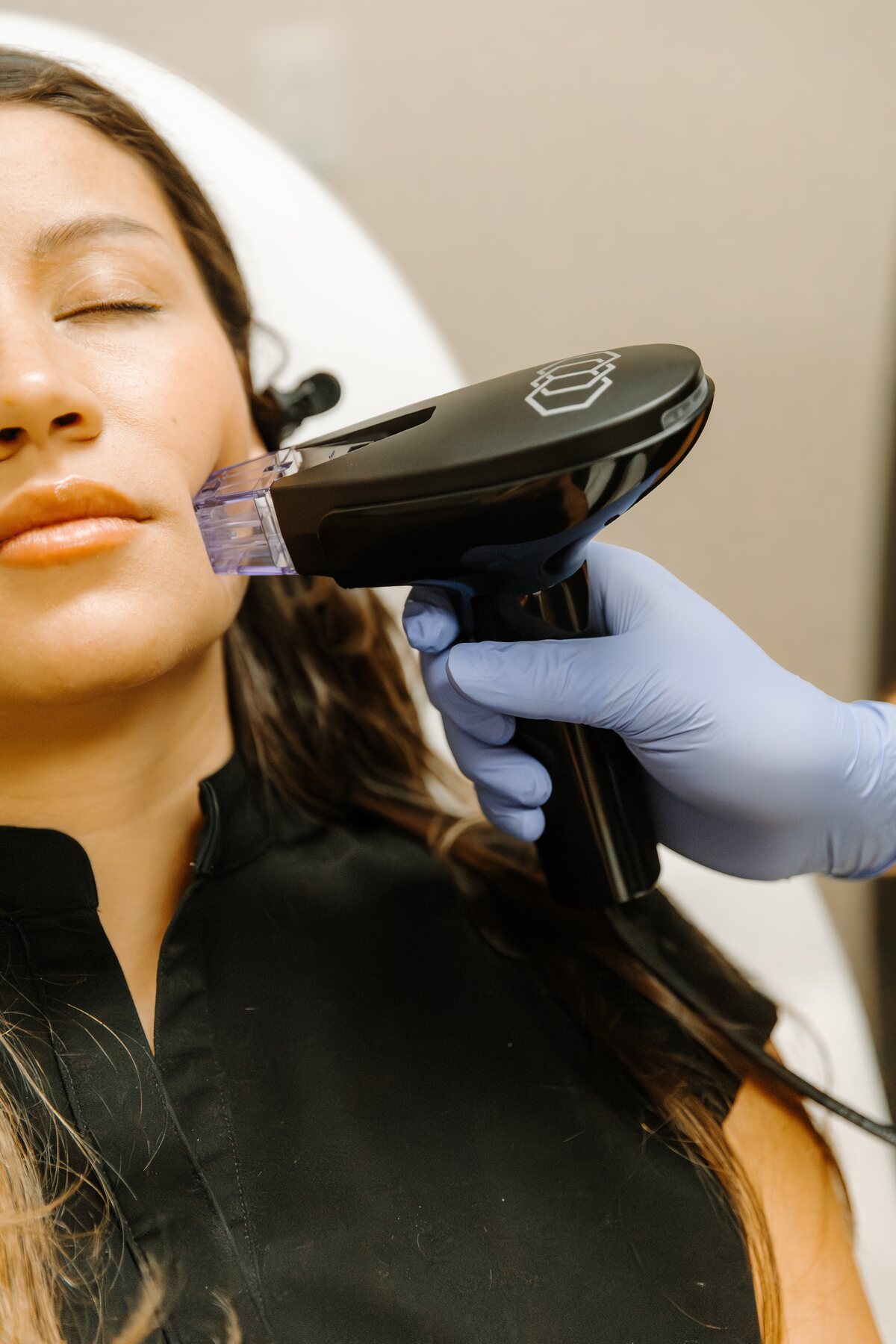 Forma Skin Tightening in Hudson, Ohio at Serene Med Spa in Hudson, Ohio